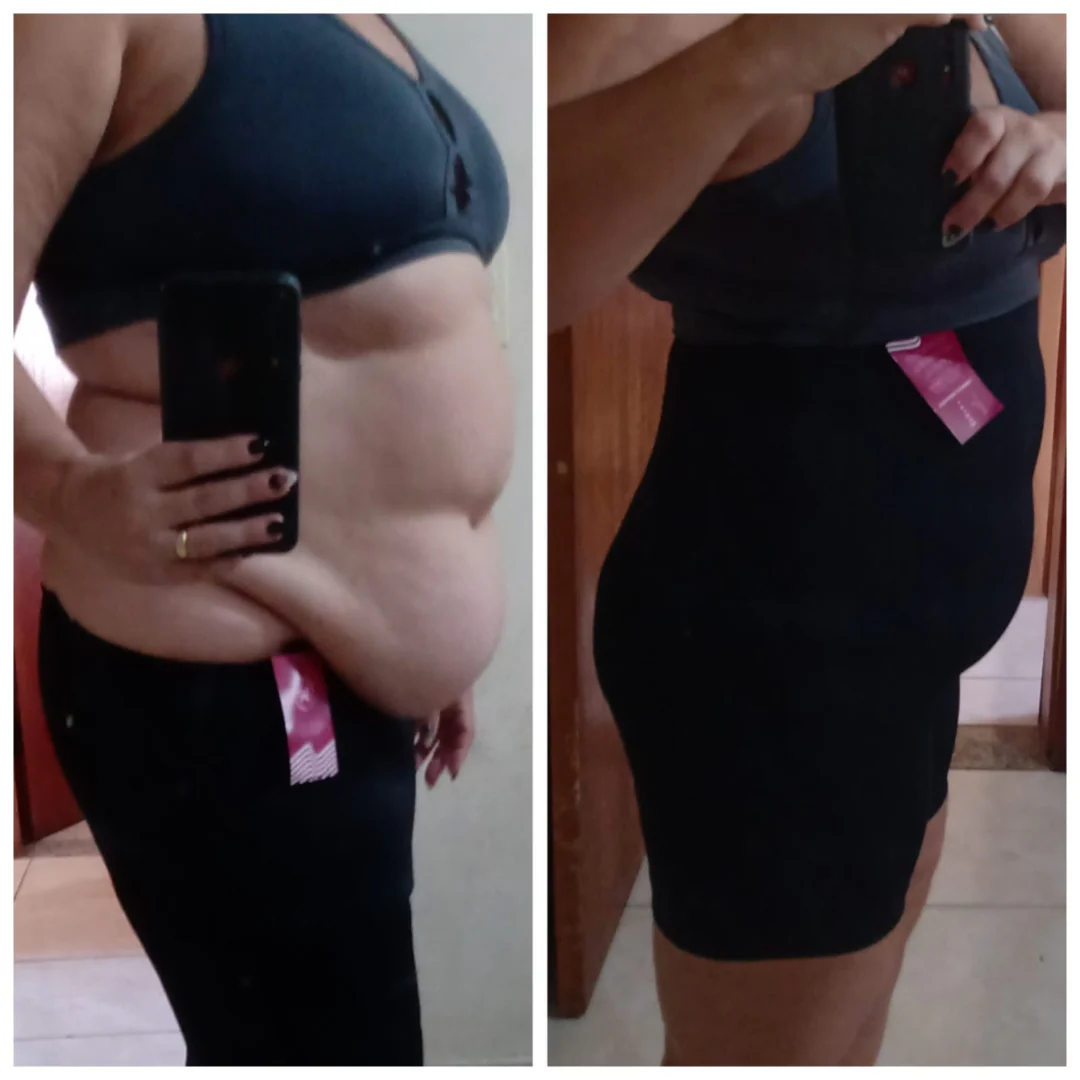 Antes e depois de cliente usando a CintaBella