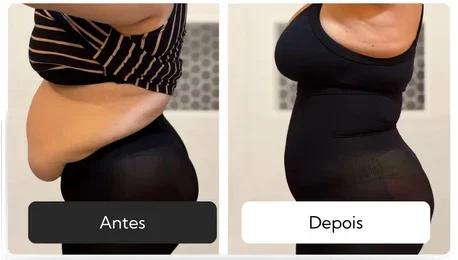 Antes e depois de cliente usando a CintaBella